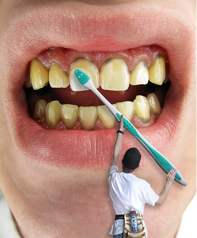 Tips för att slippa missfärgade tänder