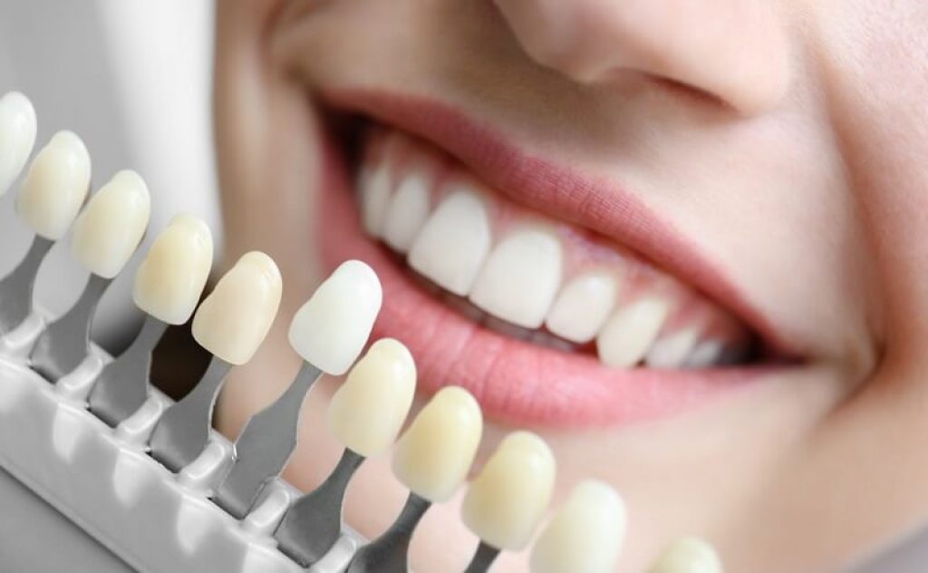 Tandkarta för att jämföra vithet på tänderna